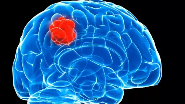 РИАН: Ученые из России разработали перспективные методы для борьбы с раком мозга
